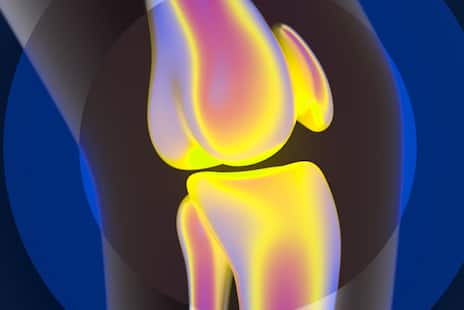 An Xray view a knee joint. The joint is highlighted in bright yellow, with circles radiating out from it.